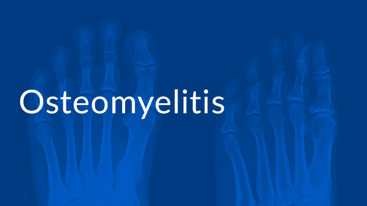 Publication: Outpatient Treatment of Osteomyelitis with Telavancin